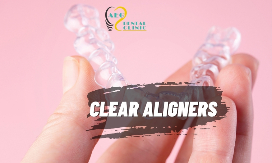 Wireless and Invisible: Clear Aligner Therapy