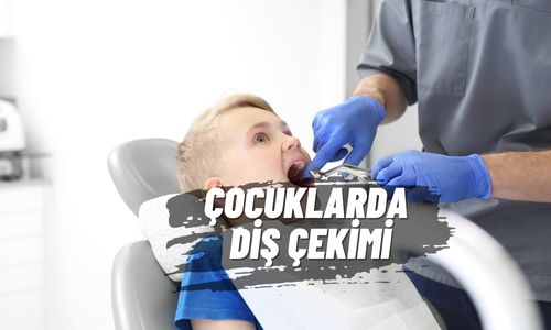 Süt Dişi Çekimi ve Yer Tutucu Uygulamaları
