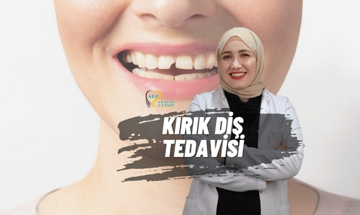Kırık Diş Tedavisi ve Estetik Bonding