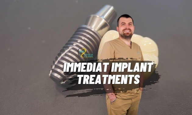 Immediate Implants: Single-Visit Smile Solutions