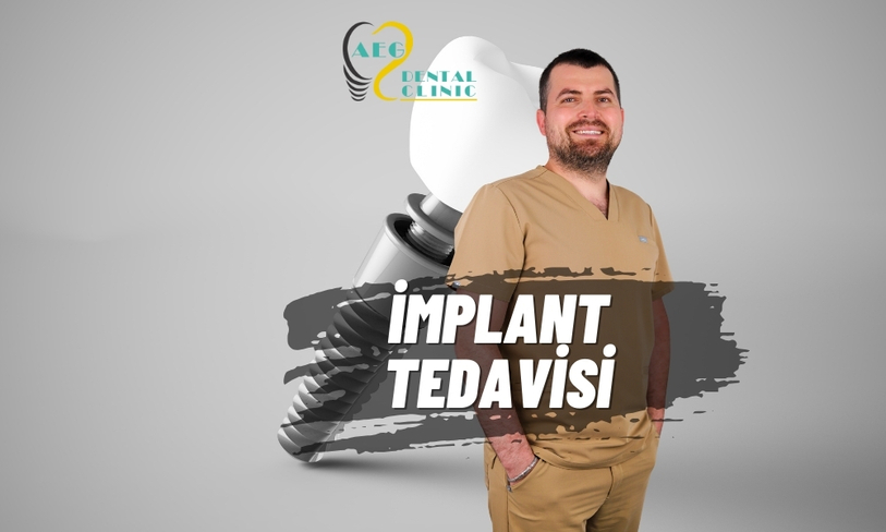 İMPLANT TEDAVİSİ (DENTAL İMPLANT)