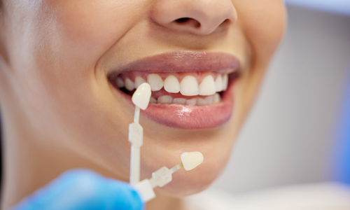 Циркониевая коронка